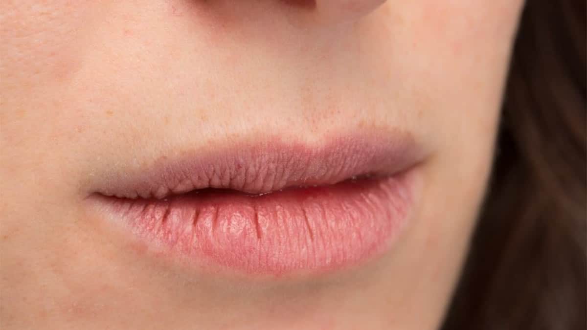 علل خشکی لب در زمستان