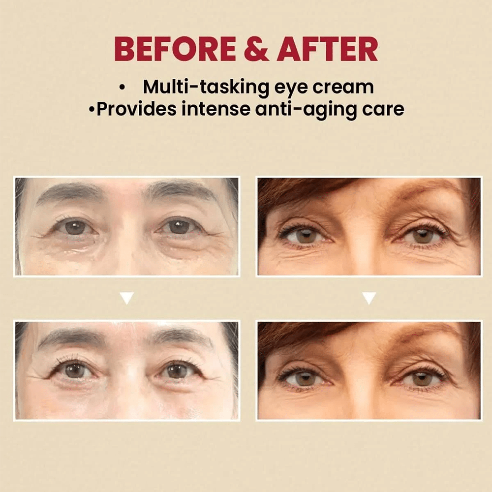 کرم دورچشم سئول ۱۹۸۸ کی سکرت