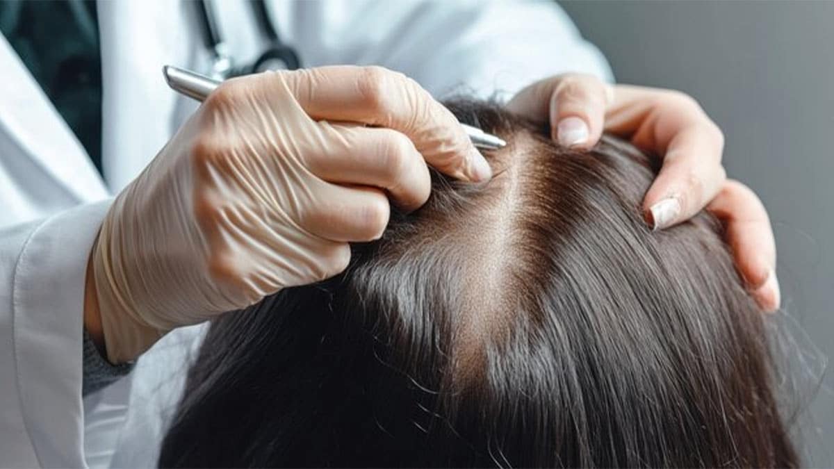 عوامل بیولوژیکی و ژنتیکی ریزش مو