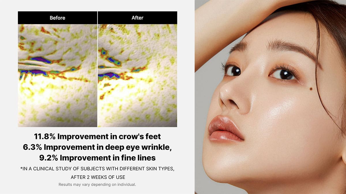 لیفتینگ دور چشم با قدرت پپتیدها