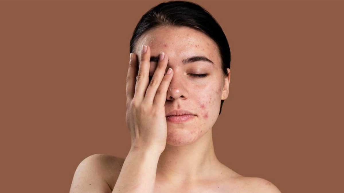 مشکلات و علائم ناشی از آلودگی هوا بر پوست