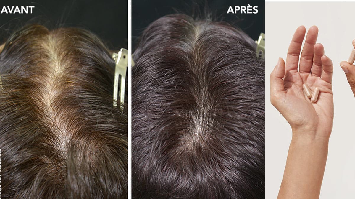 راهنمای استفاده از قرص ضد ریزش مو فیتو