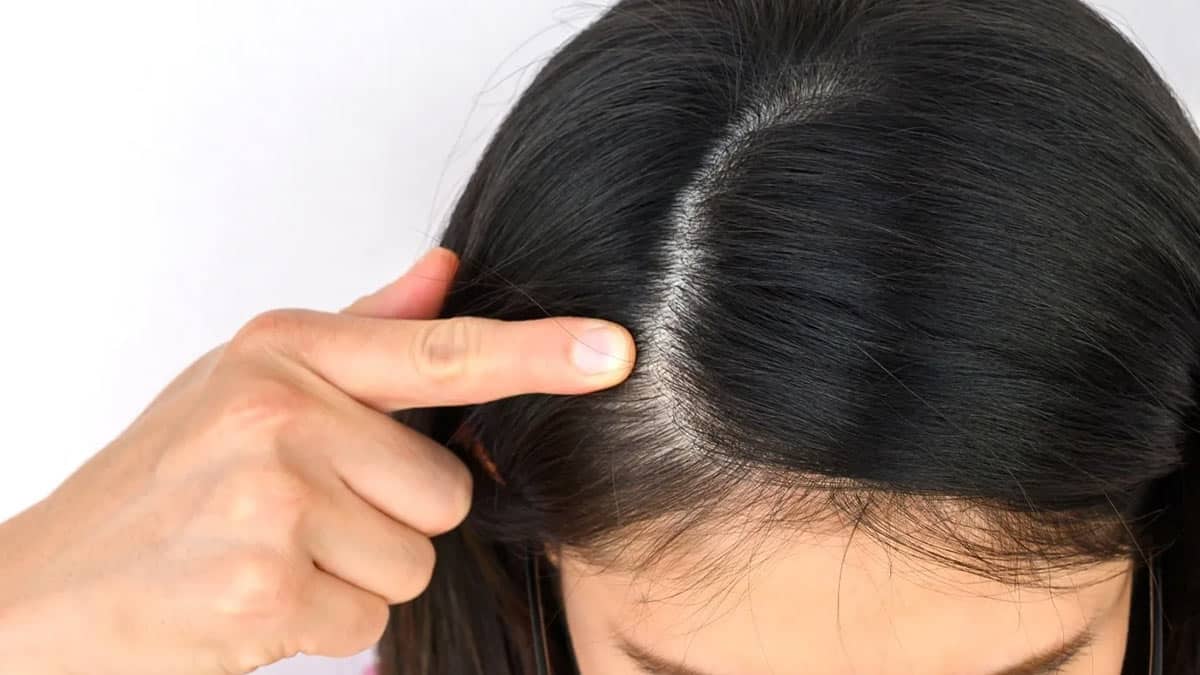 انواع پوست سر و تأثیر آن بر سلامت مو