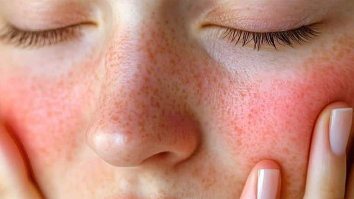 شناخت و تشخیص دقیق پوست حساس